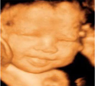 3D 4D Ultrasound Scottsdale AZ