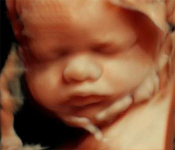 3D 4D Ultrasound Goodyear AZ